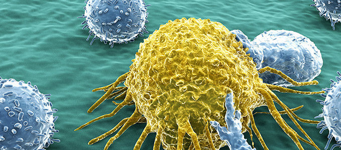 Επιθετικά λεμφώματα