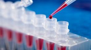 εξετάσεις μικροβιολογία λοίμωξη πανδημία