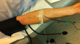 αναιμάι αιμοληψία μετάγγιση