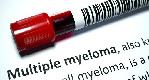 μυέλωμα μεταμόσχευση