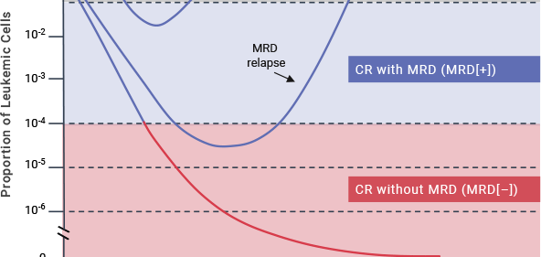 mrd πολλαπλούν μυέλωμα