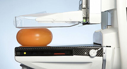 μαστογραφία καρκίνος